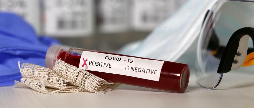Rund vier Prozent aller Coronavirus-Tests in Berlin sind positiv. 