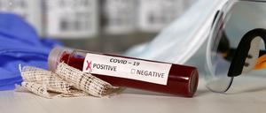Rund vier Prozent aller Coronavirus-Tests in Berlin sind positiv. 