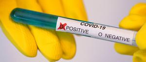 Almost 2000 people in Berlin have tested positive for Covid-19.