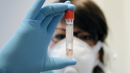 Coronavirus-Test im Labor