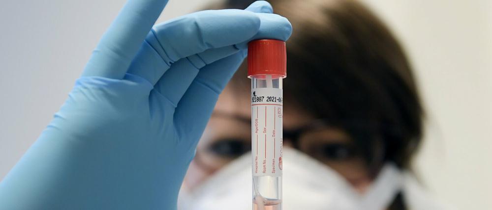 Coronavirus-Test im Labor