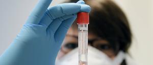 Coronavirus-Test im Labor