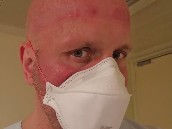 Nach einer Acht-Stunden-Schicht mit Maske und Gesichtsschutz.