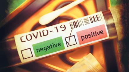 Die Hoffnung auf mehr Bewegungsfreiheit ruht auf einem positiven Antikörpertest: Weist er nach, dass jemand gegen Sars-CoV-2 immun ist, kann er nicht erneut infiziert werden und andere nicht anstecken - wahrscheinlich.