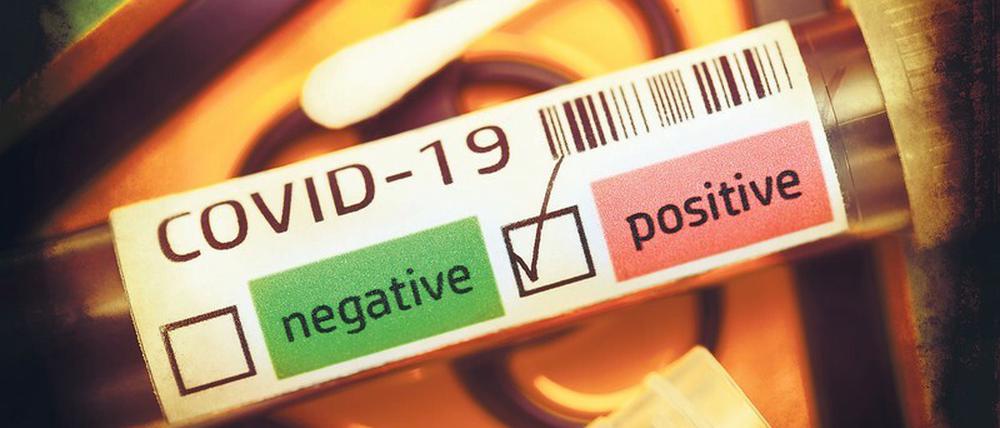 Die Hoffnung auf mehr Bewegungsfreiheit ruht auf einem positiven Antikörpertest: Weist er nach, dass jemand gegen Sars-CoV-2 immun ist, kann er nicht erneut infiziert werden und andere nicht anstecken - wahrscheinlich.