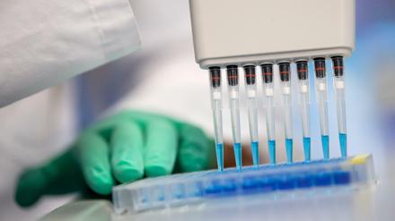 Proben von Infizierten werden auf Antikörper gegen das Coronavirus getestet.