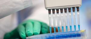 Proben von Infizierten werden auf Antikörper gegen das Coronavirus getestet.