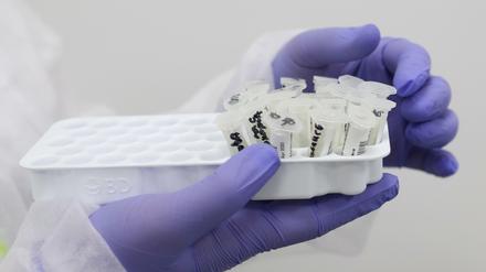 Ein Labormitarbeiter hält Tests auf das Coronavirus.