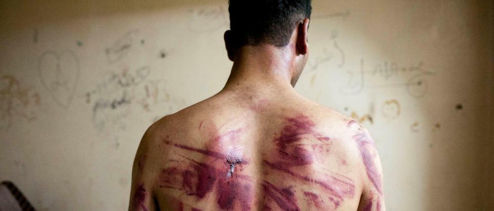 Dieser Syrer wurde von Regimekräften schwer gefoltert, das Foto wurde im August 2012 in Aleppo gemacht.