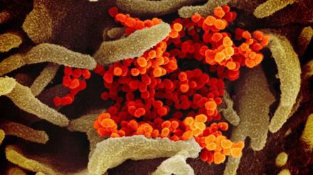 Mit dem Coronavirus infiziert oder nicht? Der neue Test soll innerhalb von Minuten Ergebnisse liefern können.
