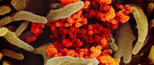 Mit dem Coronavirus infiziert oder nicht? Der neue Test soll innerhalb von Minuten Ergebnisse liefern können.