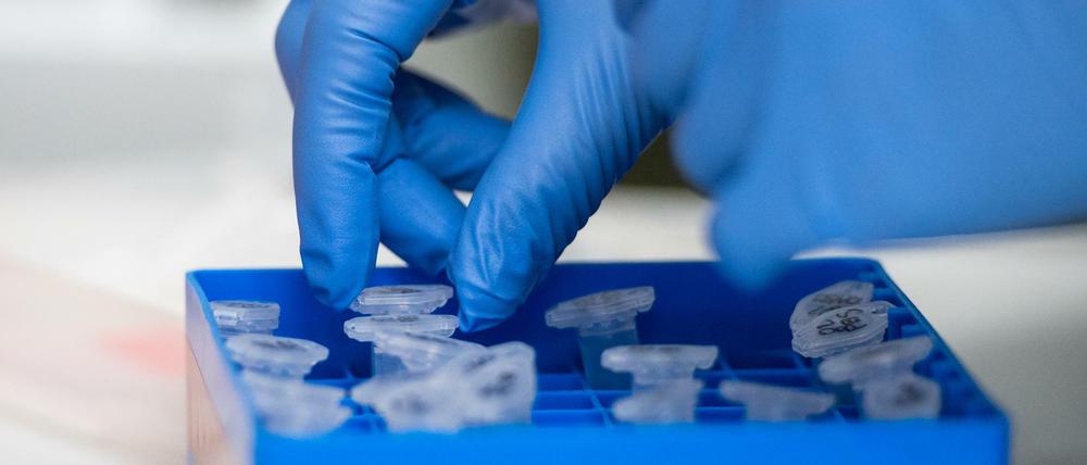 Eine Laborantin sortiert im Institut für Virologie an der Charité in Berlin-Mitte die Proben.