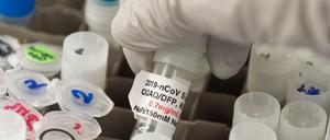 Proben zur Forschung am Coronavirus in einem US-Labor in Rockville, Maryland