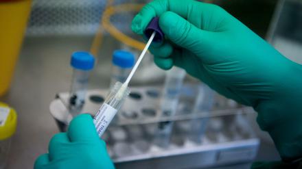 In einem Labor wird ein Abstrich auf das Coronavirus untersucht.