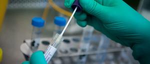 In einem Labor wird ein Abstrich auf das Coronavirus untersucht.