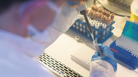 Die Impfstoffentwicklung dauert oft Jahre. Ministerin Karliczek hofft, dass es „in zwölf bis 18 Monaten“ ein Mittel gegen Covid-19 gibt.