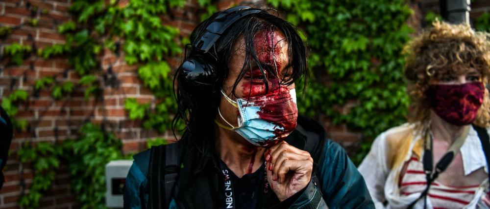 Ein Journalist in Minneapolis blutet, nachdem die Polizei begonnen hat, mit Tränengas und Gummigeschossen gegen die Demonstranten vorzugehen. 