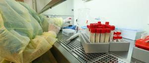 Ein Labortest auf Coronavirus (Symbolbild).