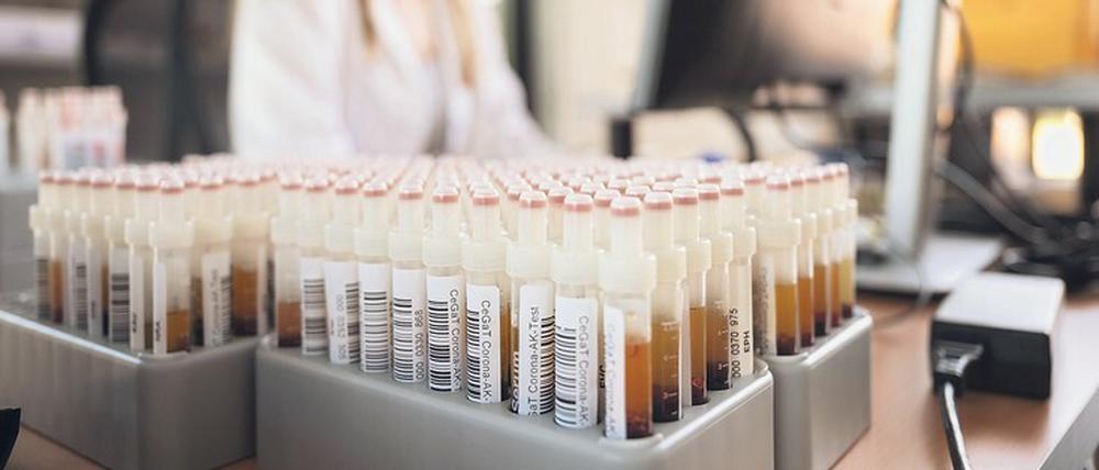 Verlässliche Antikörpertests auf das Coronavirus Sars-CoV-2 sind aufwändig und Genesene müssen über lange Zeit beobachtet werden, um Immunität zu prüfen.