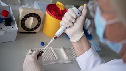 Blut wird in einem Labor auf Coronavirus-Antikörper untersucht.