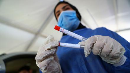 Positiver Test, langfristige Immunität? Zu diesem möglichen Schluss kommt eine Studie in Wuhan.