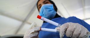 Positiver Test, langfristige Immunität? Zu diesem möglichen Schluss kommt eine Studie in Wuhan.