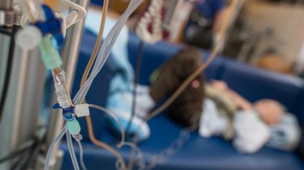  Das Risiko für Schwarze Kinder nach einer Operation zu sterben ist dreieinhalb Mal höher.