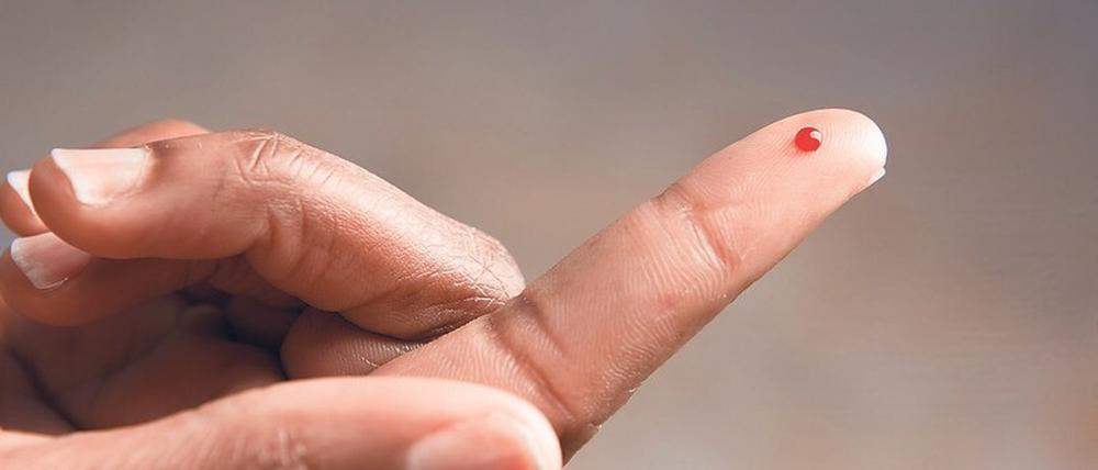 Einmal piksen. Das Testverfahren basiert auf getrocknetem Blut und kann selbst zu Hause durchgeführt werden.