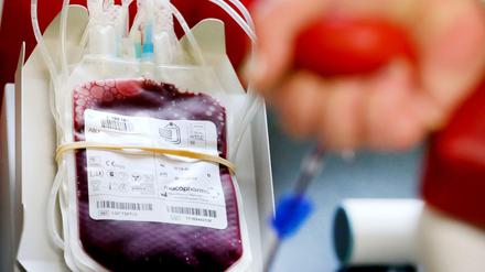 Wird das Blut verdünnt, sinkt die Todesrate – so geht es aus seiner Covid-19-Studie hervor.