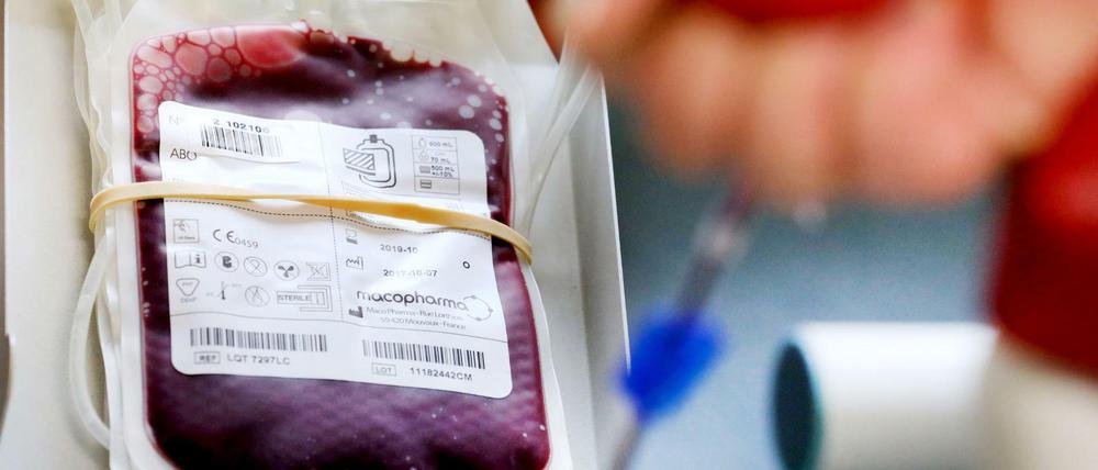 Wird das Blut verdünnt, sinkt die Todesrate – so geht es aus seiner Covid-19-Studie hervor.