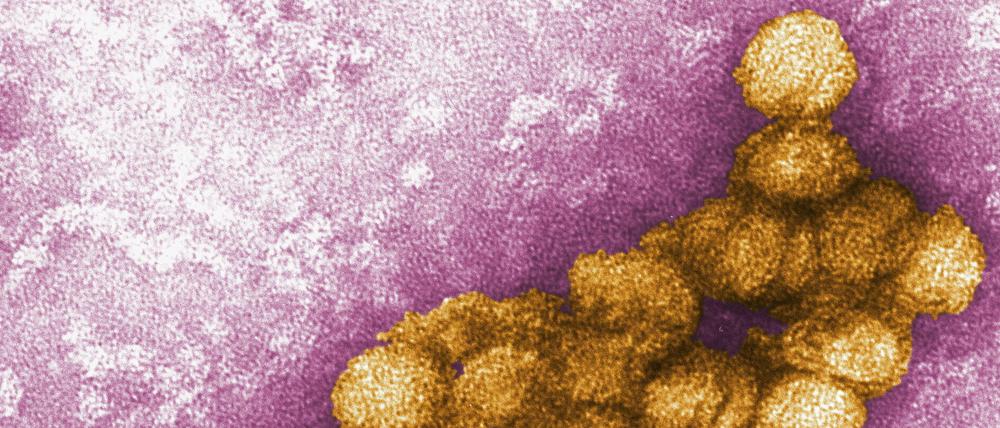 Das West-Nil-Virus unter dem Elektronenmikroskop.