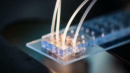 Krankheit entsteht in Zellen, weshalb das LifeTime-Konsortium sie aus Gewebe isoliert und auf Chips einzeln analysiert, um Fehlfunktionen frühzeitig erkennen und behandeln zu können.