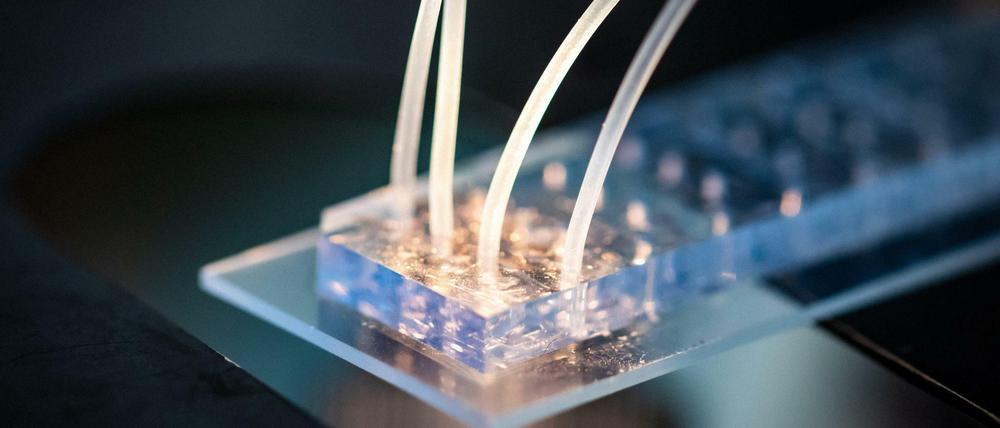 Krankheit entsteht in Zellen, weshalb das LifeTime-Konsortium sie aus Gewebe isoliert und auf Chips einzeln analysiert, um Fehlfunktionen frühzeitig erkennen und behandeln zu können.
