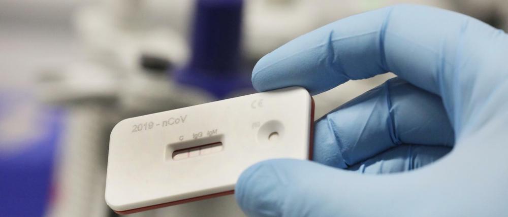 Bei den Corona-Schnelltest soll künftig innerhalb von 15 Minuten ein Ergebnis vorliegen.