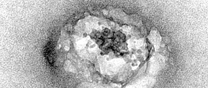 Diese elektronenmikroskopische Aufnahme eines Hepatitis-C-Virus wurde im Jahr 2016 als erstes Bild des Erregers von Forschenden des französischen Nationalen Instituts für Gesundheit und medizinische Forschung (Inserm) veröffentlicht.