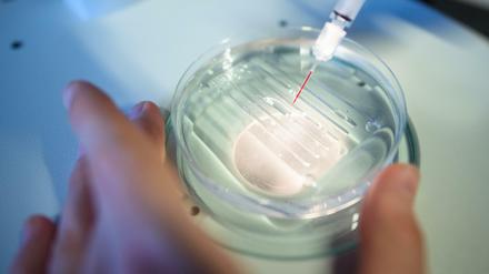 Eine Mitarbeiterin wendet das CRISPR/Cas9-Verfahrens in einem Labor an.