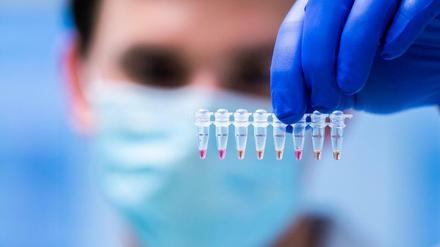 Hunderttausende sind vom Coronavirus betroffen - vielleicht sollten sie wegen der Folgeschäden in speziellen Zentren versorgt werden.