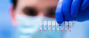 Hunderttausende sind vom Coronavirus betroffen - vielleicht sollten sie wegen der Folgeschäden in speziellen Zentren versorgt werden.