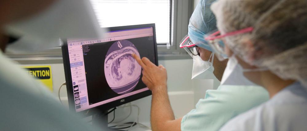 Straßburg: Medizinisches Personal bespricht ein Röntgenbild der Lunge eines Corona-Patienten im Nouvel Hopital Civil.