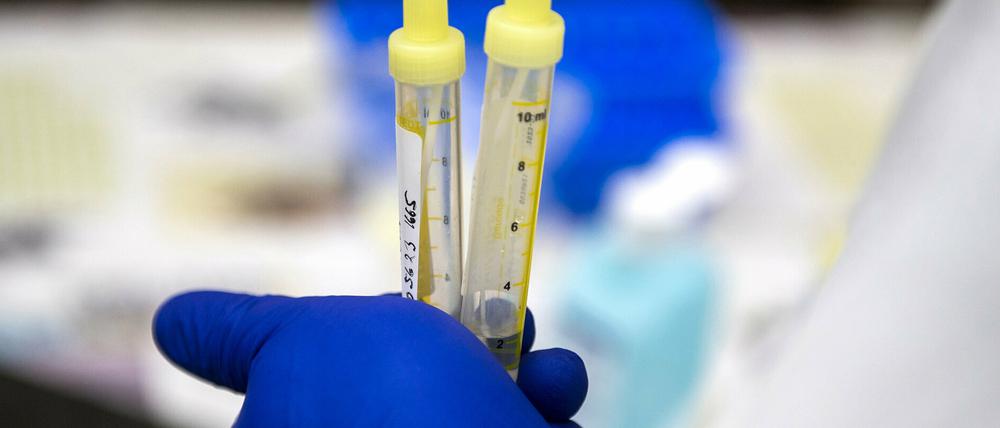 03.11.2020, Tschechien, Trebechovice pod Orebem: Ein Mitarbeiter des Gesundheitswesens, bekleidet mit Schutzhandschuhen, hält zwei Kanülen mit Abstrichen von Corona-Tests. Die regionale Feuerwehr fährt zu Seniorenheimen und anderen sozialen Einrichtungen, in denen Menschen wohnen, die nicht an Sammel-Tests teilnehmen können. Dafür spendete die Region ihnen einen alten Krankenwagen. Foto: David Taneèek/CTK/dpa +++ dpa-Bildfunk +++