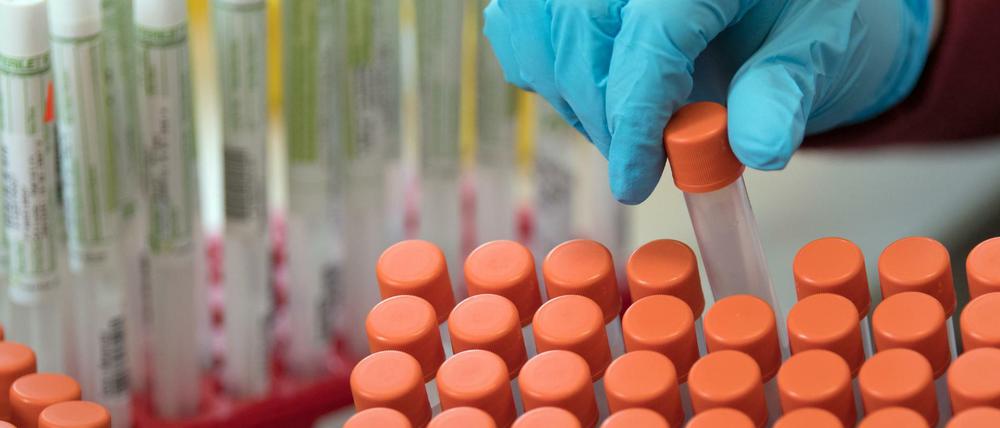 Proben von Coronavirus-Tests werden für die Untersuchung vorbereitet.