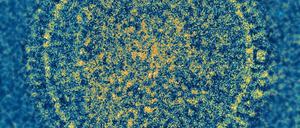 Kein Corona. Es gibt zwar auch viele Viren, die nicht kugelig und stachelig ausssehen. RSV gehört aber nicht dazu. Doch dass die Ähnlichkeiten zu Coronaviren rein oberfächlich wären, kann man nicht behaupten. Eher das Gegenteil ist der Fall.
