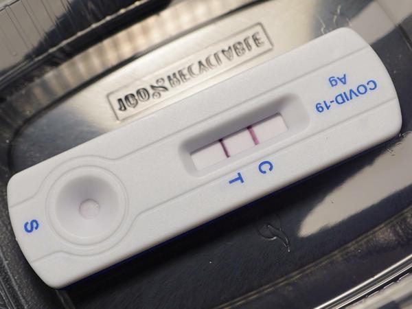 Corona-Schnelltest-Utensilien.