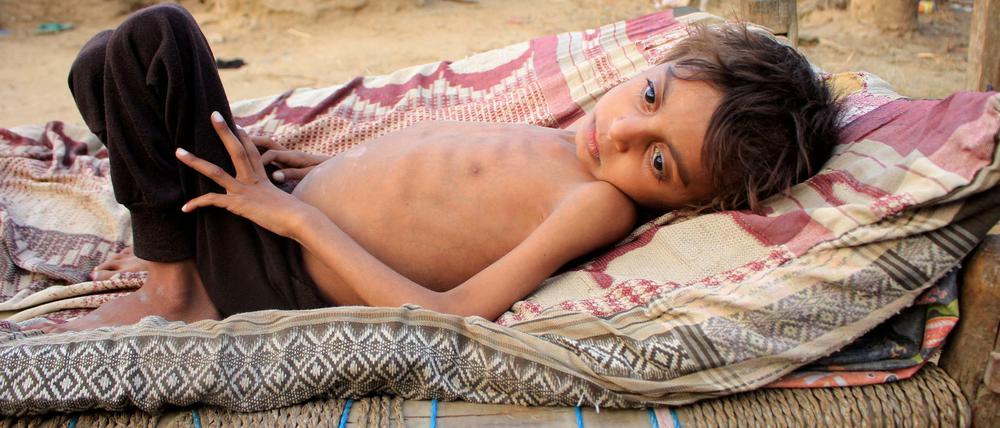 Millionen Kinder schweben in Lebensgefahr - sie hungern.