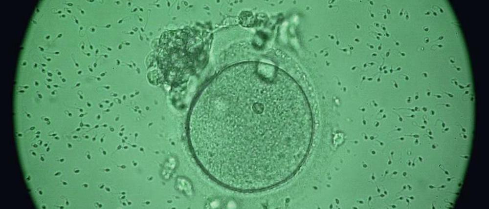Die entnommenen Eizellen werden bei Minus 196 Grad in Stickstoff gelagert und später für die Befruchtung - wie hier im Bild - wieder aufgetaut.