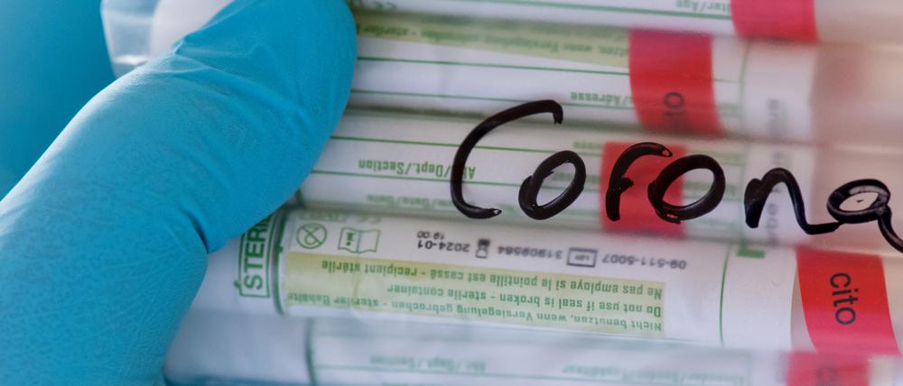 Proben für Corona-Tests werden im Diagnosticum-Labor im sächsischen Plauen für die weitere Untersuchung vorbereitet.
