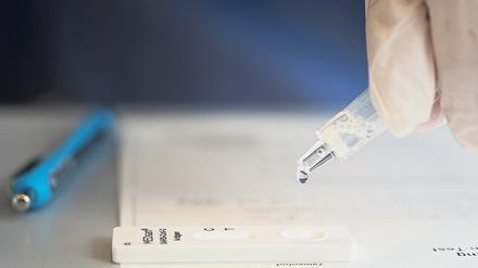 Testflüssigkeit wird auf das Testgerät getropft.