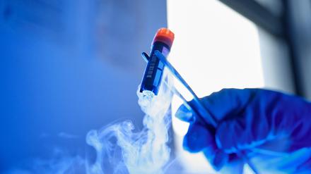 BeimFoodtech Bluu Biosciences forscht man am Texturen aus der Petrischale, die wie Fisch schmecken sollen.