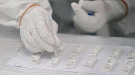 In den kostenlosen Schnelltests stecken viele Hoffnungen auf schrittweise Öffnungen.