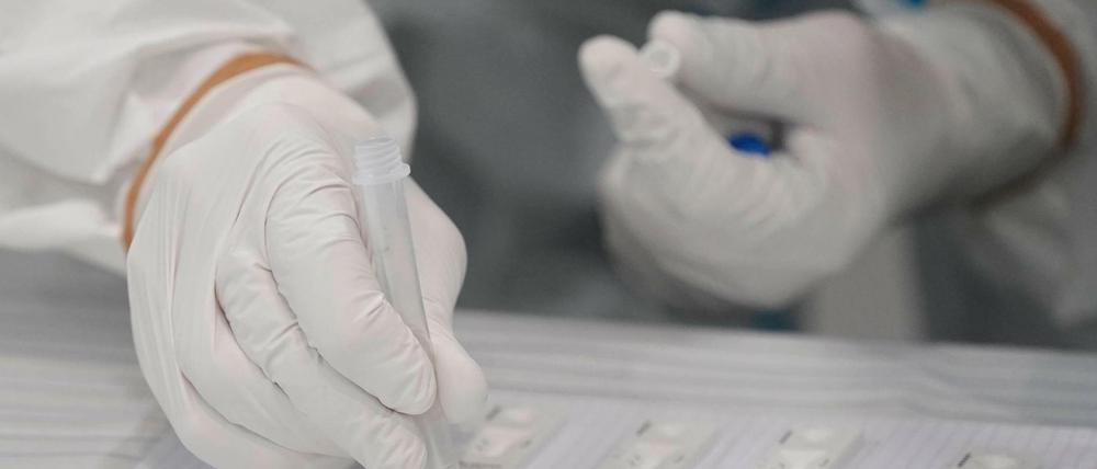 In den kostenlosen Schnelltests stecken viele Hoffnungen auf schrittweise Öffnungen.